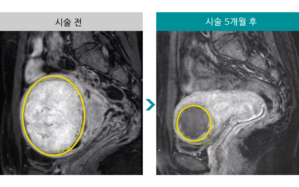 28세색전술.jpg