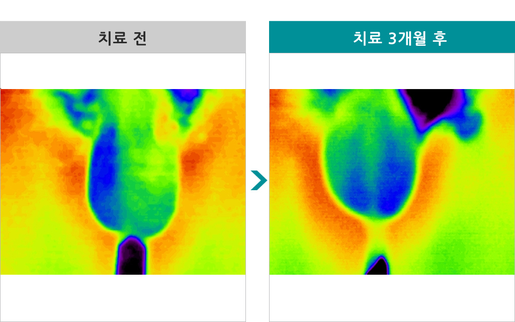 17세정계색전술00.jpg