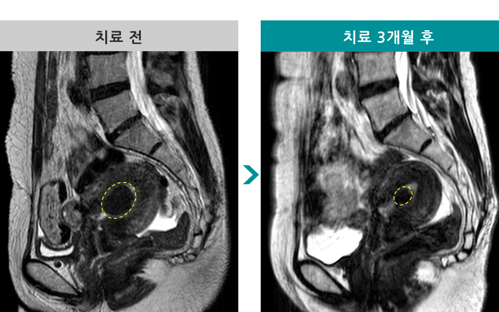 47점막하하이푸.jpg