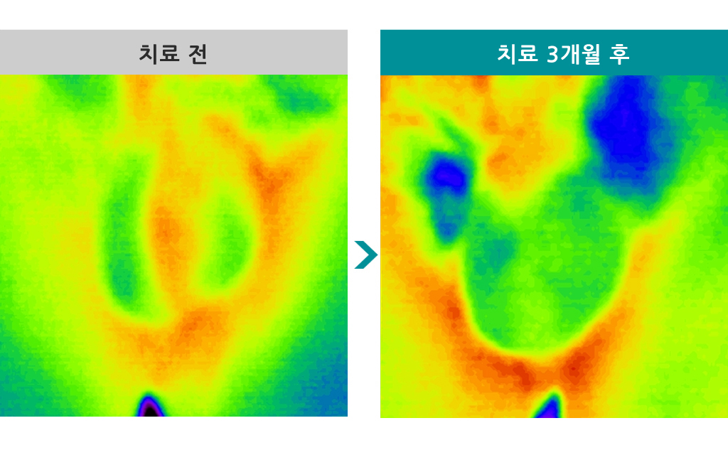 28세정계색전술.jpg