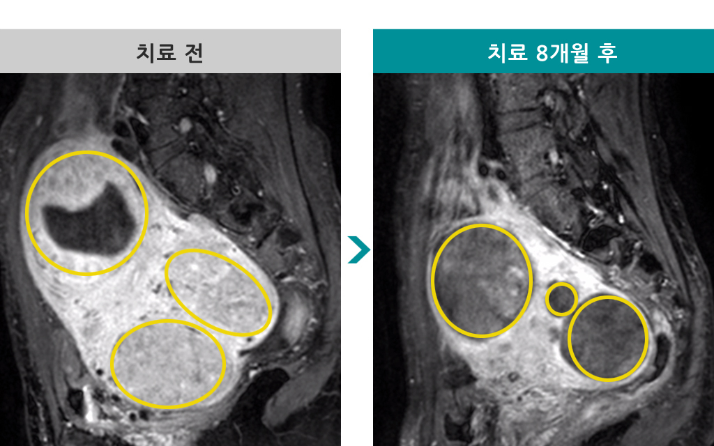 44세색전술.jpg