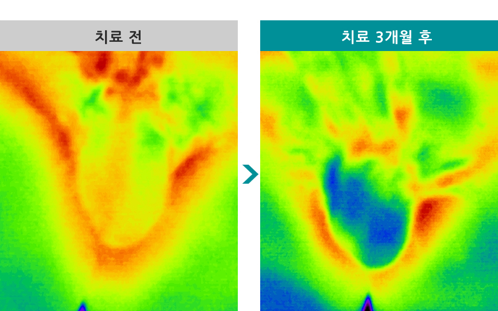 35세정계색전술.jpg