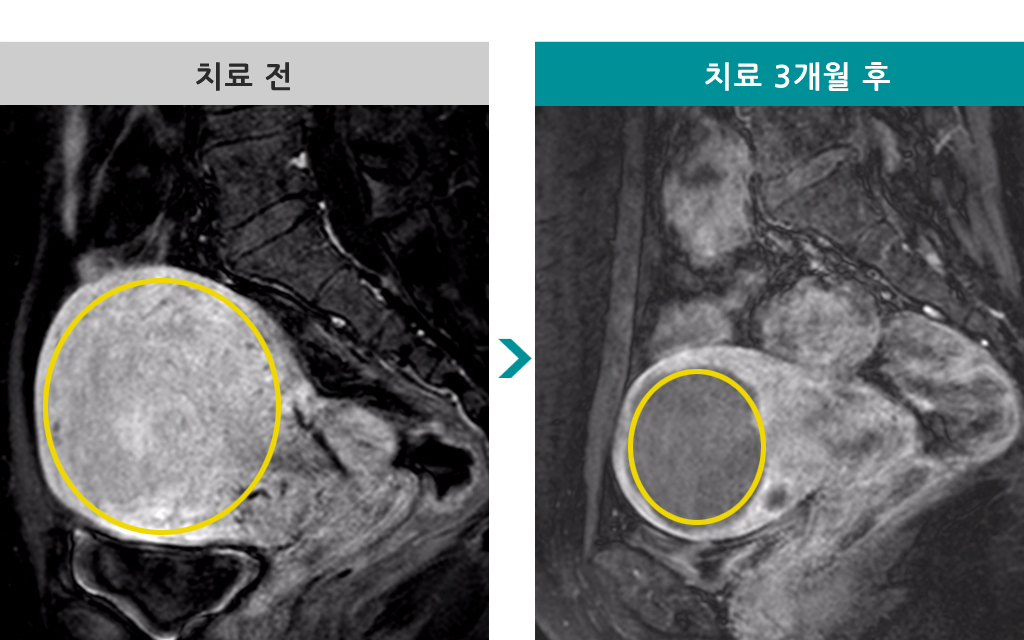 51세색전술.jpg