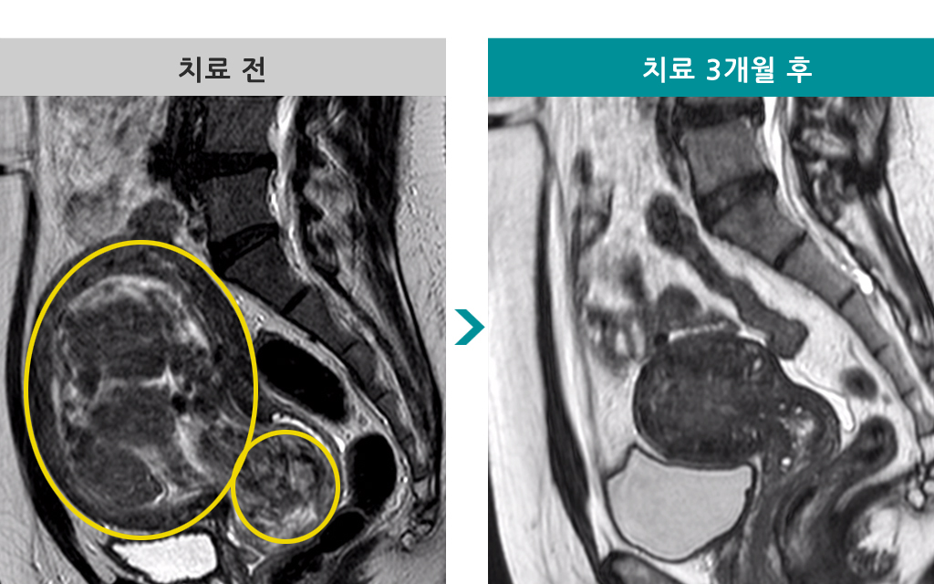 48세점막하.jpg