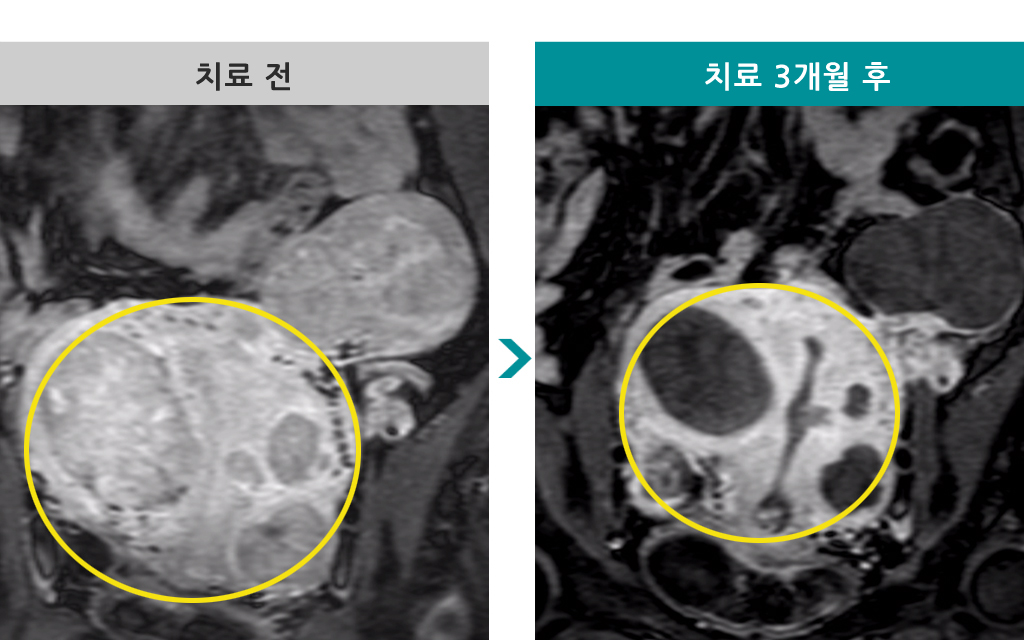 840042색전술48세.jpg