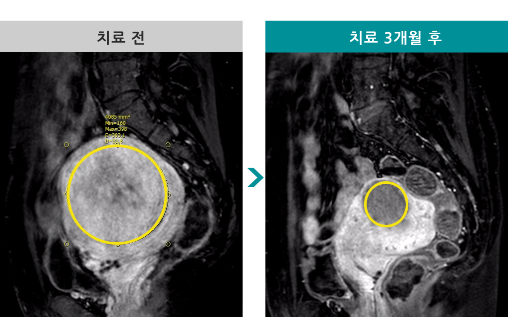 838218색전술45세.jpg