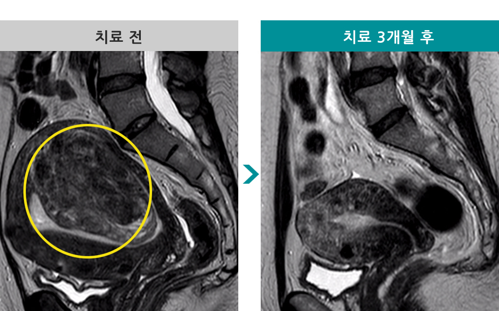 832437색전술42세.jpg