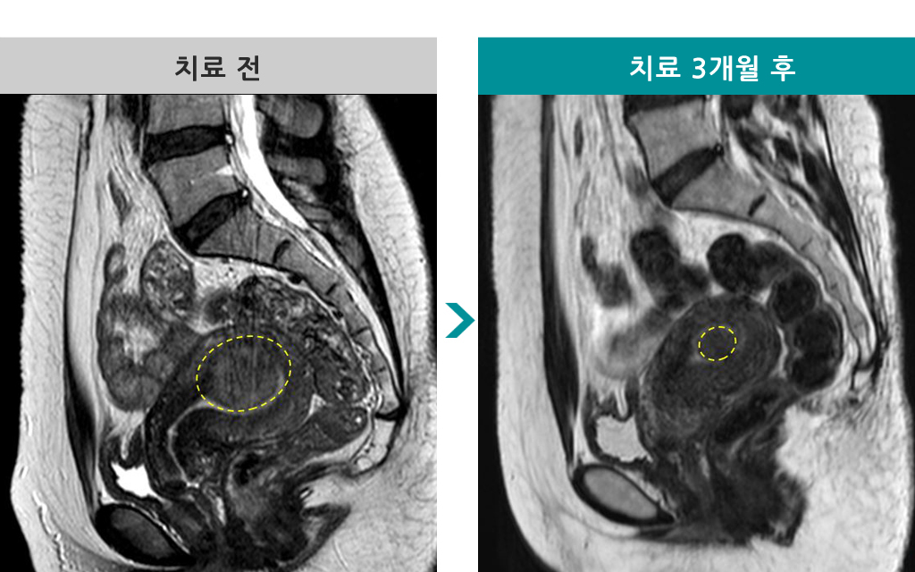 839275하이푸39세.jpg