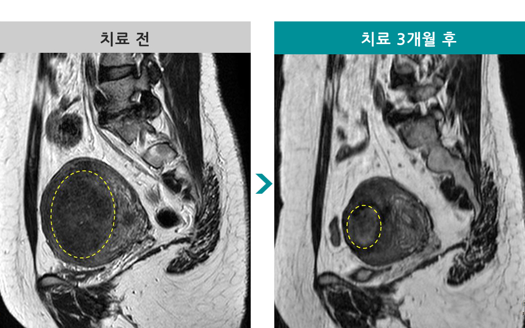 838866하이푸43세.jpg