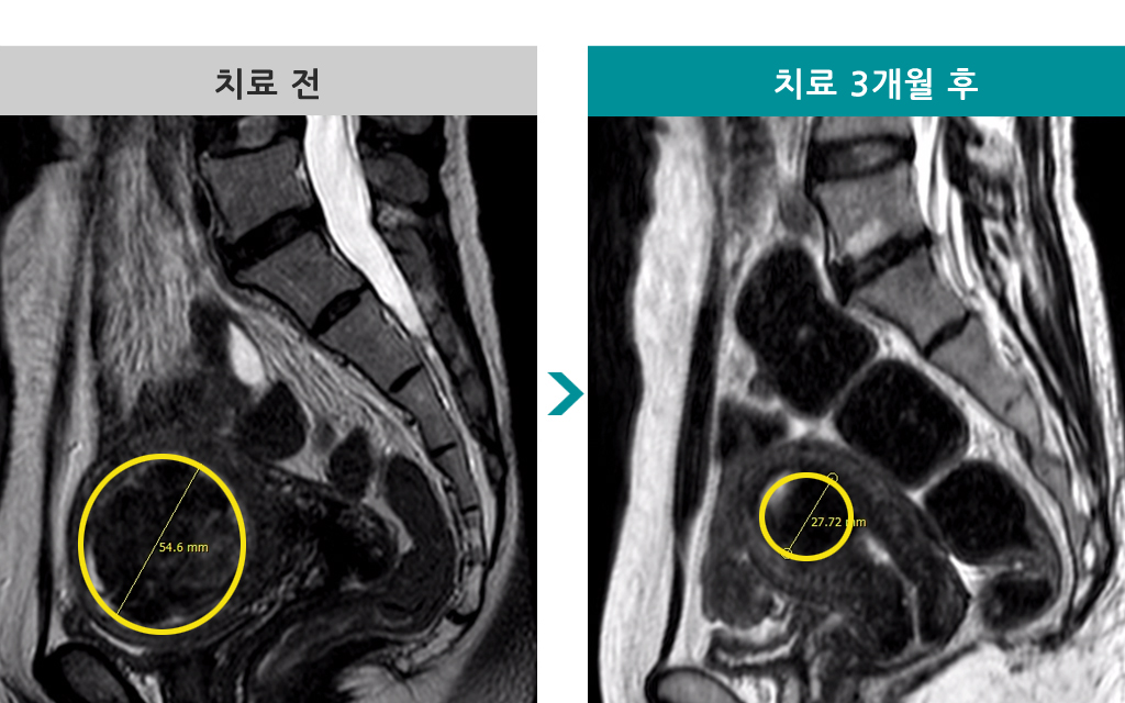 49세839607색전술.jpg