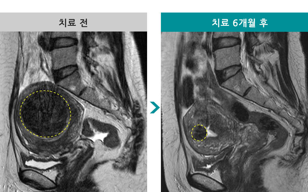 48 하이푸 00838664.jpg