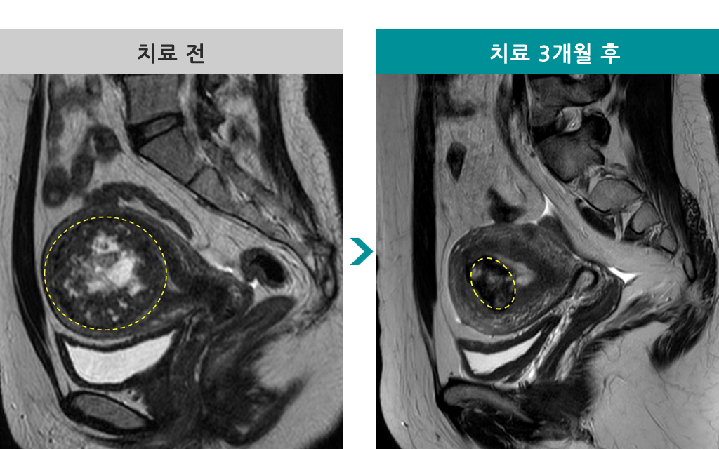 00842161하이푸38세.jpg