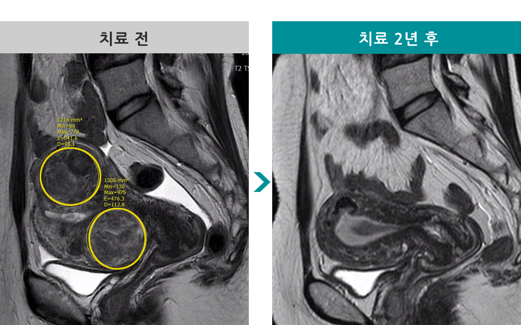 42세색전술2년00823714.jpg