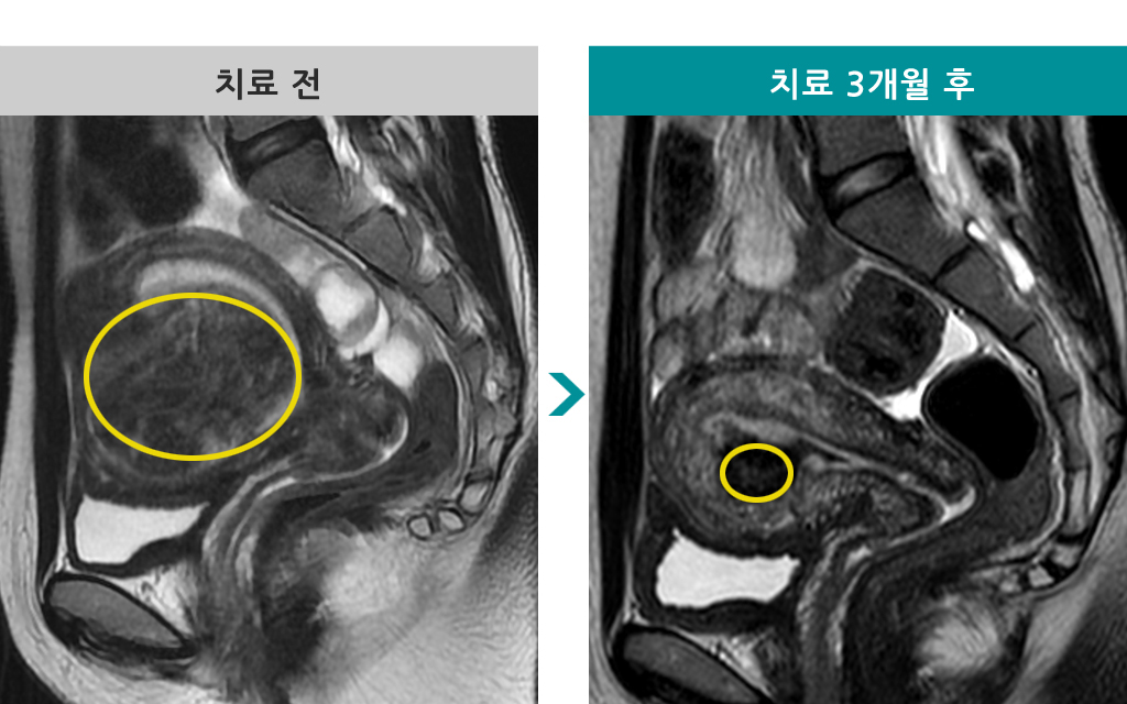 36세하이푸00836936.jpg