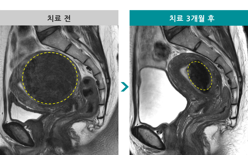 35세00843626MR하이푸.jpg